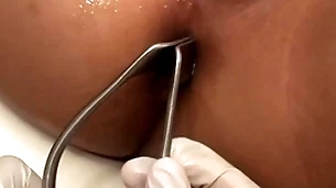 Asian invalid penetrated wide anal hole by stud wide missionary