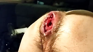 Singular fisting my loose hole and prolapse:)